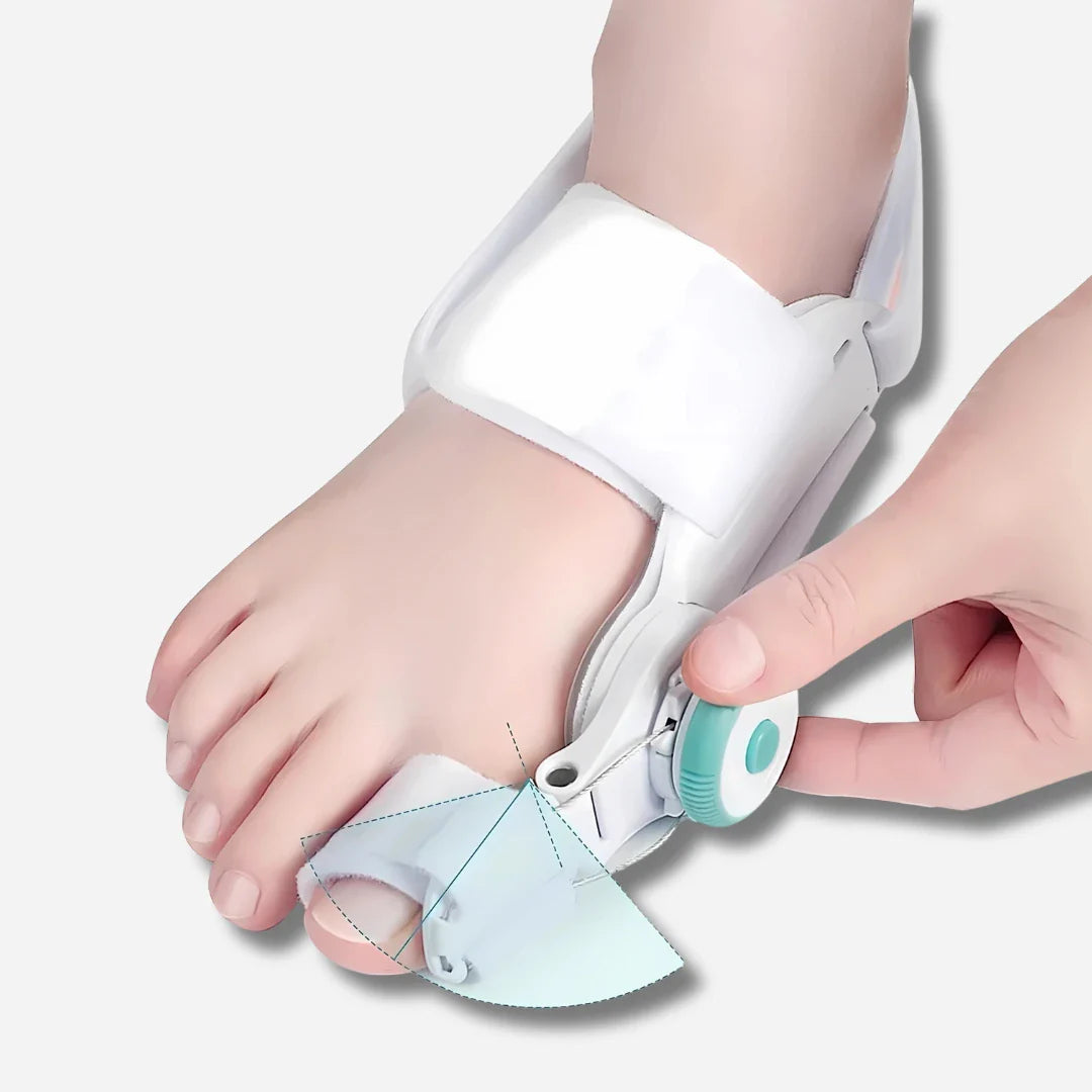 Justerbar tåkorrektor til hallux valgus og bunion korrektion