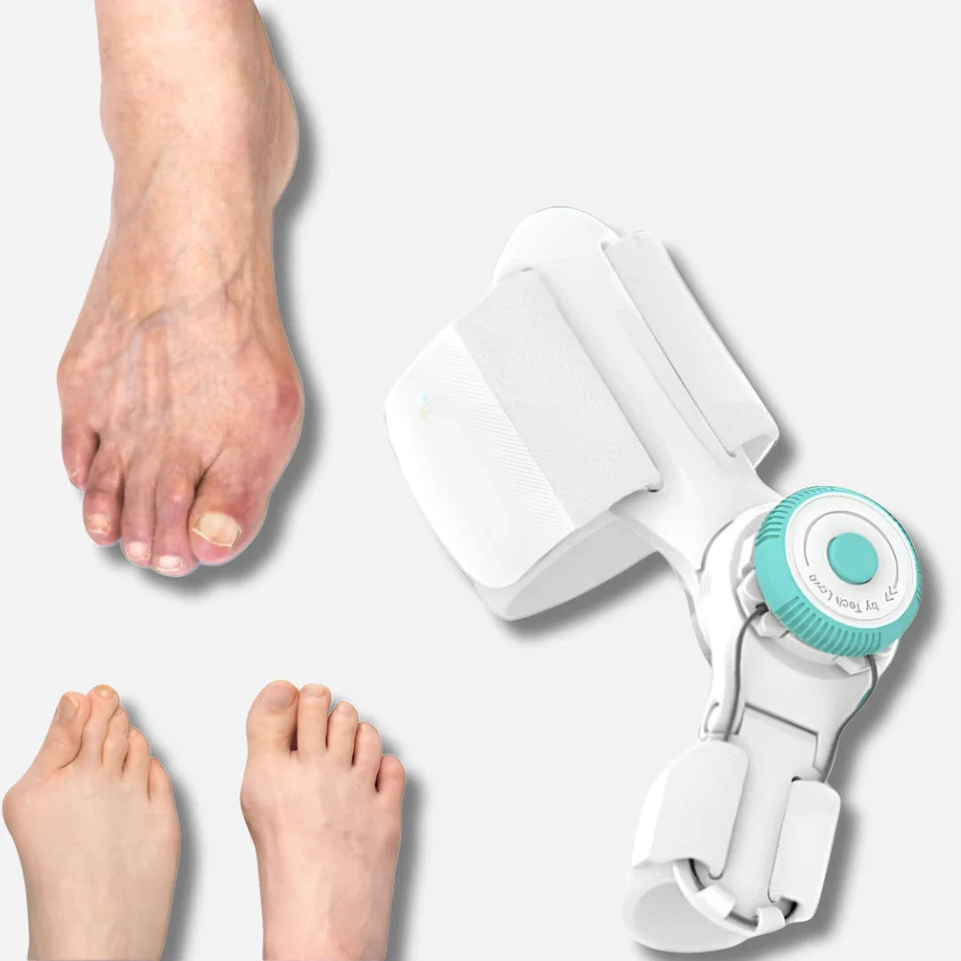 Justerbar tåkorrektor til hallux valgus og bunion korrektion